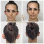 Foto 1:  Dra Alessandra Jung Cirurgiã Dentista