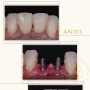 Foto 1:  Dra Alessandra Jung Cirurgiã Dentista